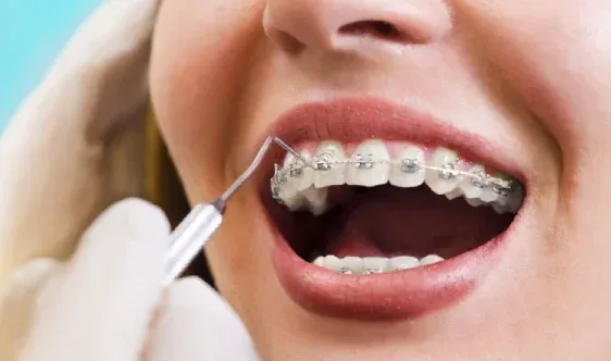 Orthodontics